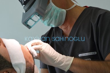 Hair Transplant Turkey Surgery Dr. Kayihan Sahinoglu