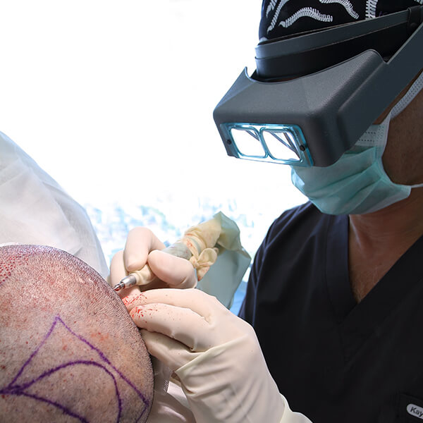 Hair Transplant Turkey Surgery Dr. Kayihan Sahinoglu - Graft Extraction