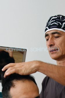 Dr. Kayihan Sahinoglu | Hair Transplant Surgeon