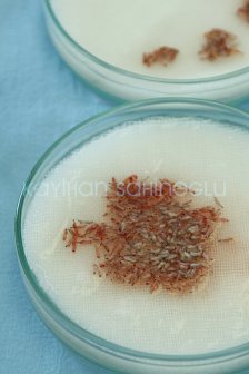 Storing The Follicular Units - Dr. Kayihan Sahinoglu | Hair Transplant Surgeon