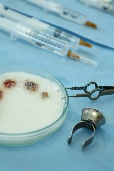 The Follicular Units - Dr. Kayihan Sahinoglu | Hair Transplant Surgeon