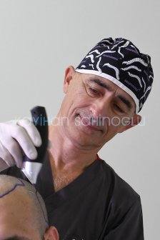 Dr. Kayihan Sahinoglu | Hair Transplant Surgeon